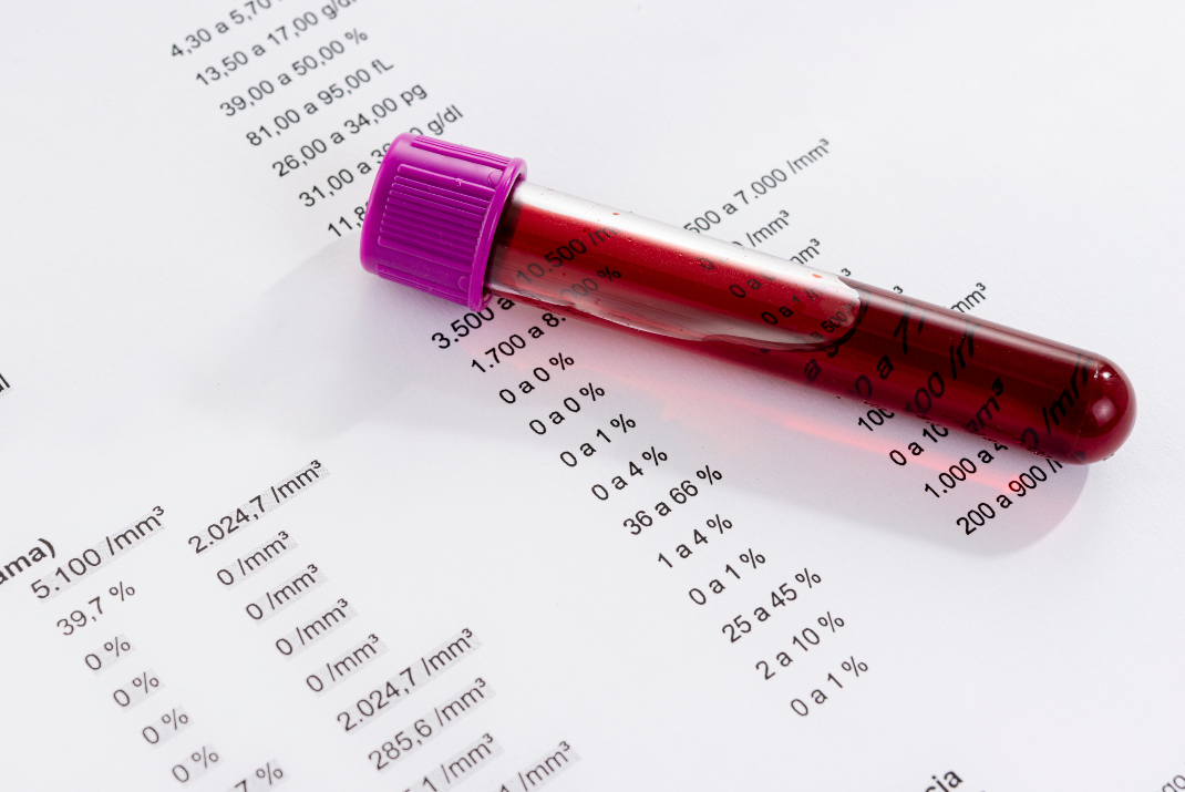 Blood sample in a testing tubes lying on the test results sheet